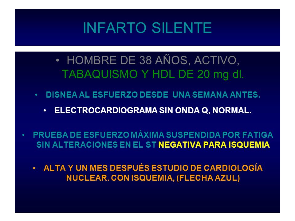 isquemia silenciosa ecg isquemia silenciosa ecg